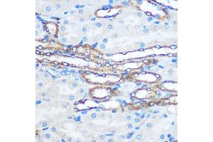 Immunohistochemistry (IHC) image for anti-Pyruvate Kinase M1/2 (PKM) (AA 11-221) antibody (ABIN6145714)