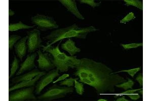 Immunofluorescence of purified MaxPab antibody to CAP1 on HeLa cell. (CAP1 抗体  (AA 1-475))