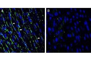 Expression of TMEM66 in mouse heart - Immunohistochemical staining of frozen mouse heart sections with Anti-TMEM66 Antibody (ABIN7043863, ABIN7044034 and ABIN7044035), (1:200), followed by goat anti-rabbit-AlexaFluor-488. (TMEM66 抗体  (Intracellular, Lumenal Region))