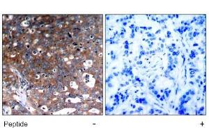 Image no. 1 for anti-Insulin-Like Growth Factor 1 Receptor (IGF1R) (Tyr1346) antibody (ABIN319345) (IGF1R 抗体  (Tyr1346))