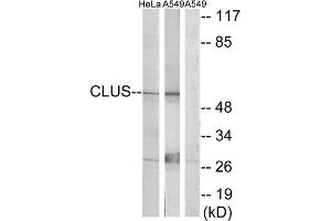 Western blot analysis of extracts from HeLa cells and A549 cells, using CLUS antibody. (Clusterin 抗体  (C-Term))