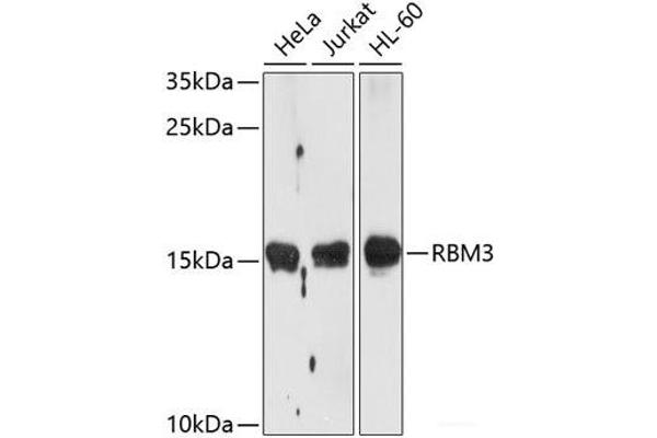 RBM3 抗体