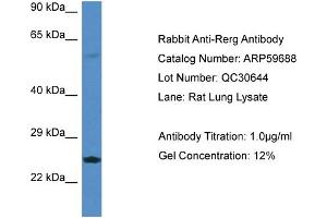Western Blotting (WB) image for anti-RAS-Like, Estrogen-Regulated, Growth Inhibitor (RERG) (Middle Region) antibody (ABIN2788162) (RERG 抗体  (Middle Region))