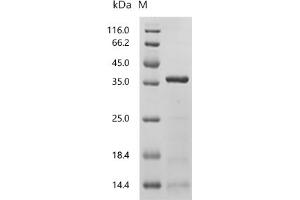 (Tris-Glycine gel) Discontinuous SDS-PAGE (reduced) with 5 % enrichment gel and 15 % separation gel.