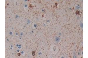 Immunohistochemistry (IHC) image for anti-Crystallin, alpha B (CRYAB) (AA 1-175) antibody (ABIN7435256)