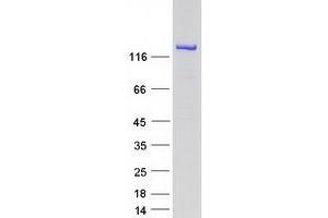 Validation with Western Blot