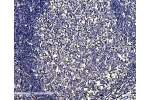 IHC analysis of SNAP23 using anti-SNAP23 antibody (ABIN7603236).