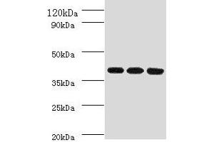 Western blot All lanes: FCGRT antibody at 2 μg/mL Lane 1: HepG2 whole cell lysate Lane 2: Mouse liver tissue Lane 3: A549 whole cell lysate Secondary Goat polyclonal to rabbit IgG at 1/10000 dilution Predicted band size: 40 kDa Observed band size: 40 kDa (FcRn 抗体  (AA 24-297))