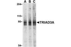 Western blot analysis of TRIAD3A in mouse heart cell lysates with this product at (A) 0. (RNF216 抗体  (N-Term))
