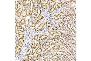 Immunohistochemistry of paraffin-embedded mouse kidney using UQCRH Rabbit mAb (ABIN7271126) at dilution of 1:50 (40x lens). (UQCRH 抗体)