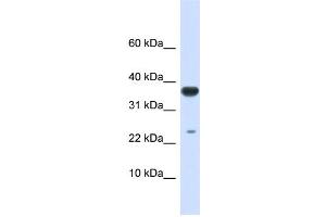 WB Suggested Anti-UBE2D2 Antibody Titration:  0. (UBE2D2 抗体  (Middle Region))
