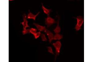 ABIN6275676 staining HeLa by IF/ICC. (CACNG1 抗体  (Internal Region))