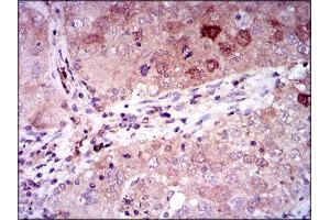 Immunohistochemistry (IHC) image for anti-Enolase 2 (Gamma, Neuronal) (ENO2) (AA 251-433) antibody (ABIN1846262) (ENO2/NSE 抗体  (AA 251-433))