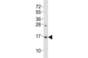 Western Blotting (WB) image for anti-Microtubule-Associated Protein 1 Light Chain 3 beta (MAP1LC3B) (N-Term) antibody (ABIN3028837)
