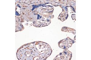 Immunohistochemistry of paraffin-embedded human placenta using IGF2 Rabbit pAb (ABIN3022872, ABIN3022873, ABIN3022874 and ABIN6219274) at dilution of 1:100 (40x lens). (IGF2 抗体  (AA 25-180))