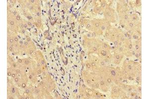 Immunohistochemistry (IHC) image for anti-Signal Transducer and Activator of Transcription 3 (Acute-Phase Response Factor) (STAT3) (AA 50-240) antibody (ABIN7169675)