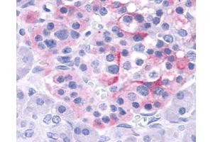 Immunohistochemistry (IHC) image for anti-Transient Receptor Potential Cation Channel, Subfamily V, Member 4 (TRPV4) (Internal Region) antibody (ABIN1049441)