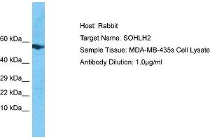 Host: Rabbit Target Name: SOHLH2 Sample Tissue: Human MDA-MB-435s Whole Cell Antibody Dilution: 1ug/ml (SOHLH2 抗体  (N-Term))
