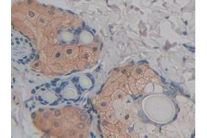 Detection of FABP9 in Rat Skin Tissue using Polyclonal Antibody to Fatty Acid Binding Protein 9, Testis (FABP9) (FABP9 抗体  (AA 1-130))