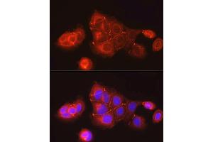 Immunofluorescence analysis of MCF7 cells using ZO-1 Rabbit pAb (ABIN1513706, ABIN3021026, ABIN3021027 and ABIN6213922) at dilution of 1:150 (40x lens). (TJP1 抗体  (AA 1600-1700))