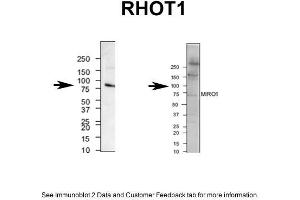 mouse brain and human neuroblastoma (RHOT1 抗体  (N-Term))