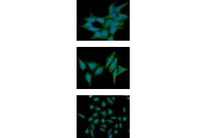 ICC/IF analysis of ST13 in 293T cells line, stained with DAPI (Blue) for nucleus staining and monoclonal anti-human ST13 antibody (1:100) with goat anti-mouse IgG-Alexa fluor 488 conjugate (Green).
