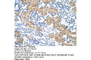 Rabbit Anti-RAE1 Antibody  Paraffin Embedded Tissue: Human Kidney Cellular Data: Epithelial cells of renal tubule Antibody Concentration: 4. (RAE1 抗体  (C-Term))