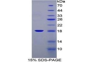 SDS-PAGE analysis of Mouse FABP1 Protein. (FABP1 蛋白)