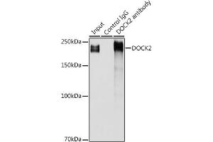 Immunoprecipitation analysis of 300 μg extracts of Jurkat cells using 3 μg DOCK2 antibody (ABIN1679578, ABIN5664348 and ABIN5664349). (DOCK2 抗体  (AA 1551-1830))