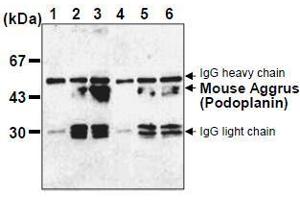 Western Blotting (WB) image for anti-Podoplanin (PDPN) antibody (ABIN1449217) (Podoplanin 抗体)
