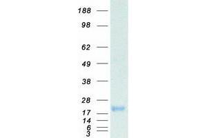 Follicle-Stimulating Hormone (FSH) (Transcript Variant 2) protein (Myc-DYKDDDDK Tag)