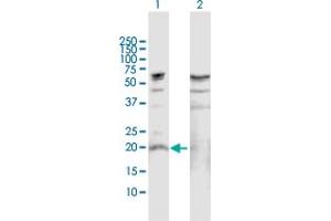 Western Blot analysis of IL19 expression in transfected 293T cell line by IL19 MaxPab polyclonal antibody. (IL-19 抗体  (AA 1-215))