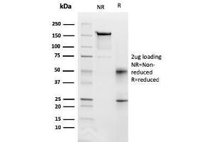 SDS-PAGE Analysis Purified CD95 Mouse Monoclonal Antibody (FAS/3112). (FAS 抗体  (AA 26-96))