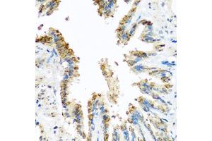 Immunohistochemistry of paraffin-embedded rat lung using BCKDK antibody (ABIN5974802) at dilution of 1/100 (40x lens). (BCKDK 抗体)
