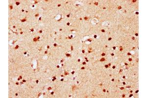 IHC image of nsucHU diluted at 1:10 and staining in paraffin-embedded human brain tissue performed on a Leica BondTM system. (HIST1H2AG 抗体  (AA 86-98))