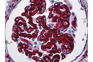 Anti-CD34 antibody IHC of human kidney, glomeruli. (CD34 抗体)