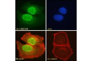 ABIN185687 Immunofluorescence analysis of paraformaldehyde fixed MCF7 cells, permeabilized with 0. (DSCAM 抗体  (Internal Region))