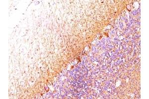 Formalin-fixed, paraffin-embedded human cerebellum stained with Neurofilament antibody (RT-97 + NR-4). (Neurofilament 抗体)