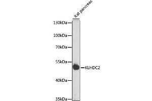 Western blot analysis of extracts of rat pancreas, using KLHDC2 antibody  at 1:1000 dilution. (KLHDC2 抗体  (AA 1-240))