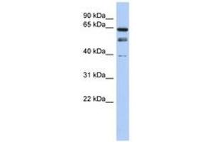 Image no. 1 for anti-MYST Histone Acetyltransferase 2 (MYST2) (N-Term) antibody (ABIN6740262) (MYST2 抗体  (N-Term))