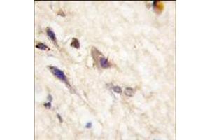 Formalin-fixed and paraffin-embedded human brain tissue reacted with EphA5 antibody (N-term), which was peroxidase-conjugated to the secondary antibody, followed by DAB staining. (EPH Receptor A5 抗体  (N-Term))
