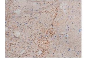 ABIN6267353 at 1/200 staining Mouse brain tissue sections by IHC-P. (MAPT 抗体  (pSer214))