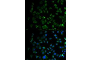 Immunofluorescence analysis of U2OS cells using MAP2K1 antibody. (MEK1 抗体  (AA 1-100))