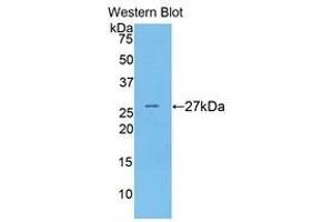 Western Blotting (WB) image for anti-Coagulation Factor IX (F9) (AA 241-463) antibody (ABIN1858772)