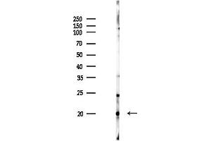 anti-Ribosomal Protein L12 (RPL12) (C-Term) antibody