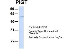 Host:  Rabbit  Target Name:  PIGT  Sample Type:  Human Adult Placenta  Antibody Dilution:  1. (PIGT 抗体  (C-Term))