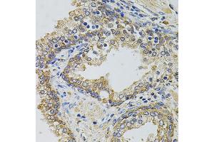 Immunohistochemistry of paraffin-embedded human prostate using GM13125 antibody. (Pramel15 抗体)