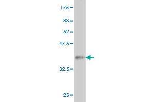Western Blot detection against Immunogen (36. (Coilin 抗体  (AA 477-575))