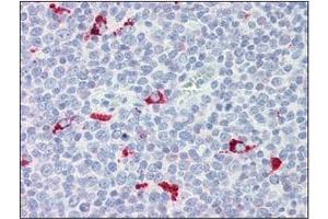 Immunohistochemistry (IHC) image for anti-Interferon Regulatory Factor 7 (IRF7) (AA 1-150), (N-Term) antibody (ABIN263914) (IRF7 抗体  (N-Term))