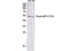 Western Blot (WB) analysis of specific cells using Phospho-MEF-2 (T319) Polyclonal Antibody. (MYEF2 抗体  (pThr319))